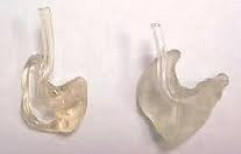 Hard/Soft Ear Molds by Shruti Hearing Aid Services