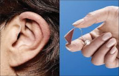 Hearing Aid Selection And Fitting by Vivek Mohans Speech And Hearing Centre