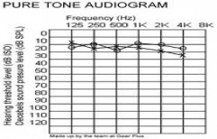 Pure Tone Audiometry by Vivek Mohans Speech And Hearing Centre