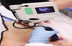 Video Laryngoscopy by Meditech Electro Services