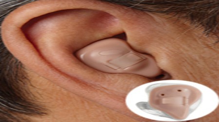 In-The- Canal (ITC) by Tarang Speech And Hearing Clinics