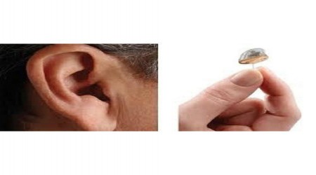 Siemens IIC Hearing Aid by Supertone Hearing Solution