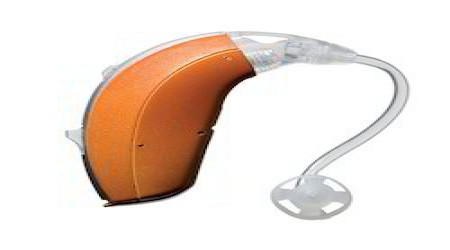 Hearing Aid by Smile Speech & Hearing Clinic