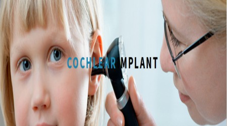 Cochlear Implant by Tarang Speech And Hearing Clinics