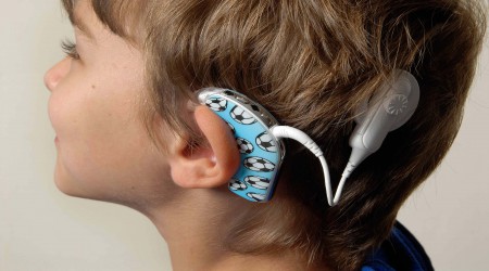 Cochlear Implants by National Speech And Hearing Center