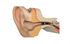 Starkey Hearing Aid