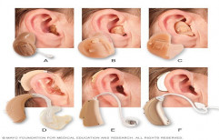 ReSound Skin Wireless Hearing Aid, Behind The Ear